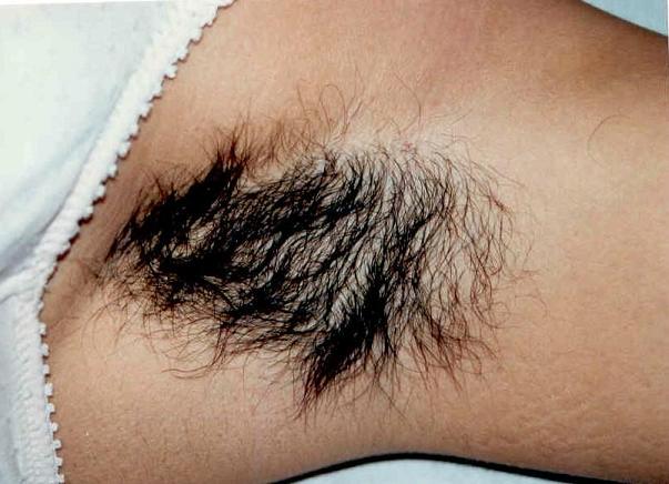 Пирсинг на волосатой вагине фото